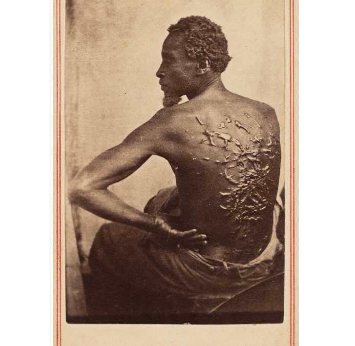 National park to remove photo of enslaved man’s scars