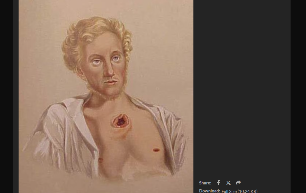 Dangers of Disease in American Revolutionary War